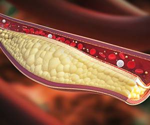 This Blood Test Can Save Your Life
